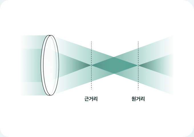 다초점 인공수정체 다이어그램